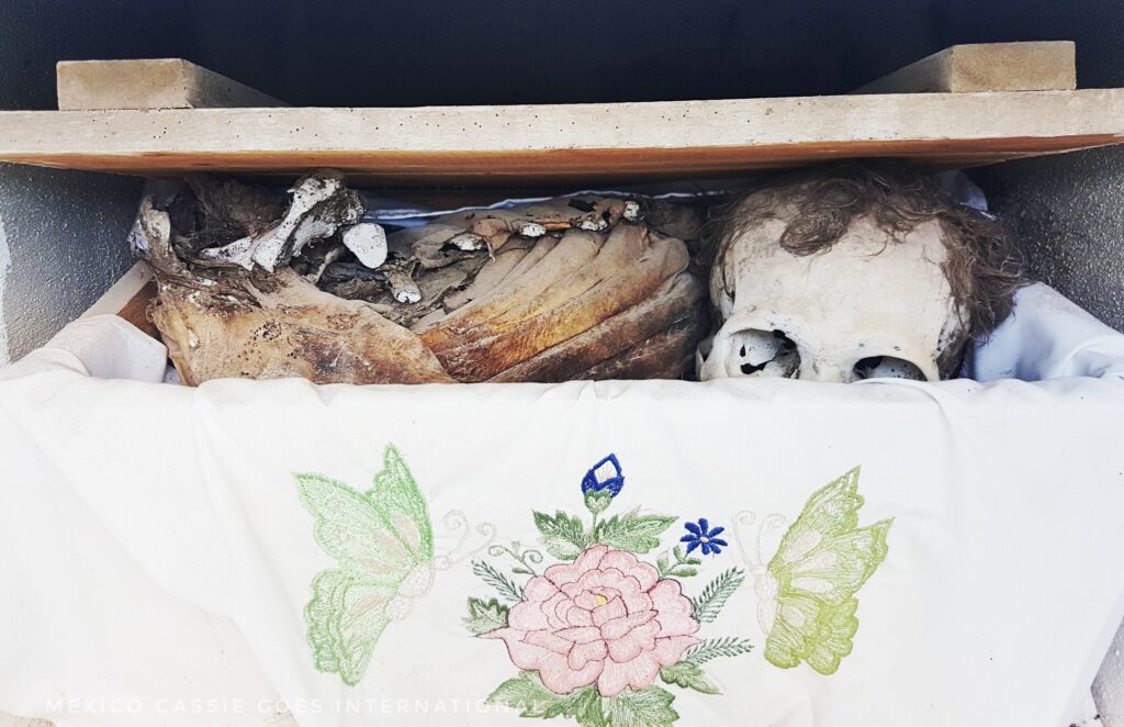 Open box with skull (with hair) visible